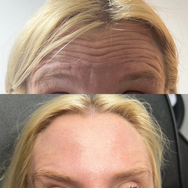 Before & After – 3