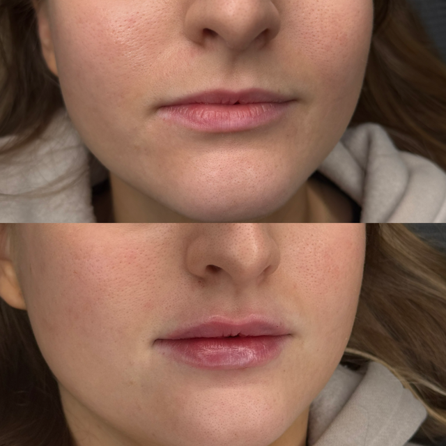 Before & After – 1