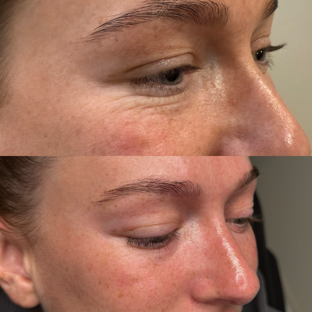 Before & After – 4