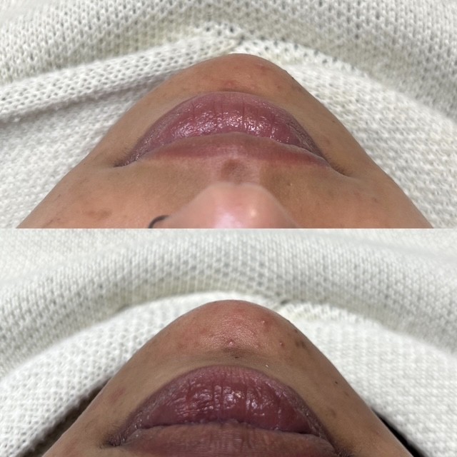 Before & After – 2